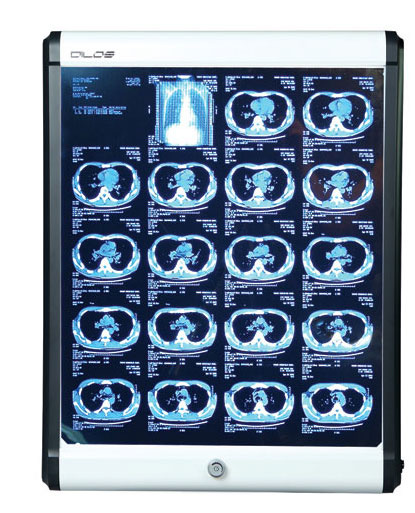 ĐÈN XEM PHIM X-Quang - KHAY CHỨA PHIM